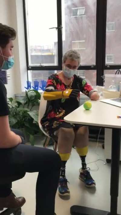 Caroline survived COVID, Kidney failure, Sepsis, and a quadruple amputation. See her joy using her new bionic hand for the first time. :)