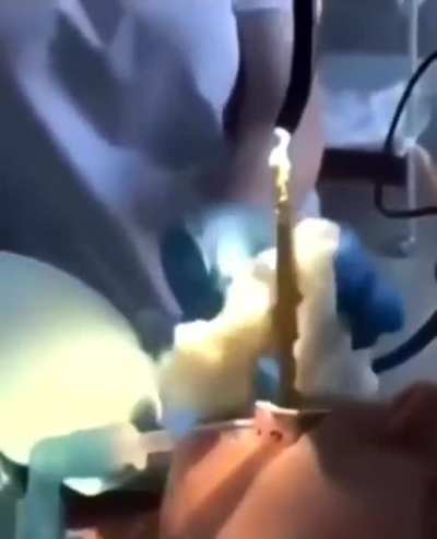 Medics pull 4ft snake from woman’s mouth after it slithered down there while she slept.