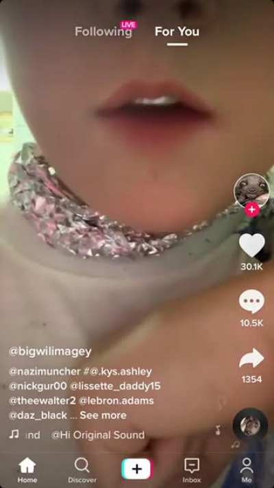 This kid really put aluminium foil on his teeth and said it was worth 2 million dollars