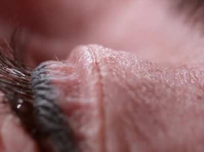 Eye drops slow motion close up