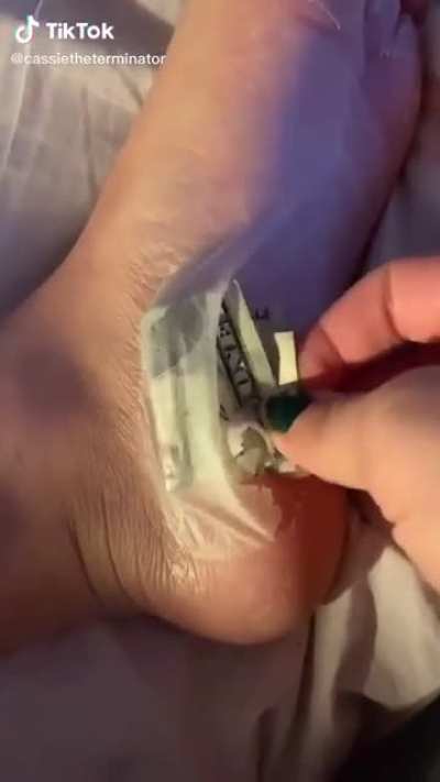 Um