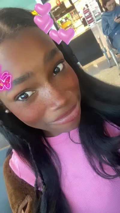 Girl gets forehead reduction surgery and it turned out like this…