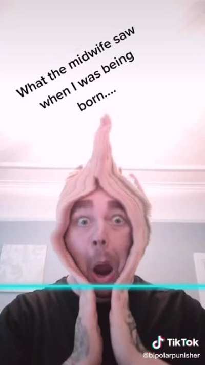 That’s Looks Painful
