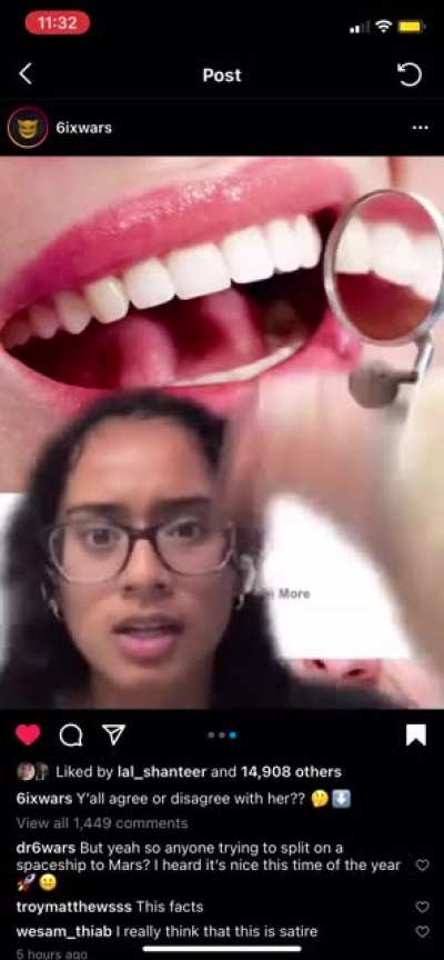 It disgusts me that we reached to a point where we can’t even have normal teeth ffs