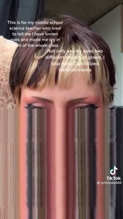 They are a survivor ? If my teacher told me my eyes were brown i would cry ?