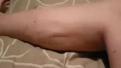 This cramp looks so very painful.