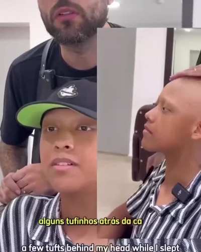 Making people smile with hair prosthesis