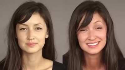 Alcohol flush reaction , Also known as "Asian Glow" (before and after drinking)