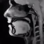 X-RAY of a person talking