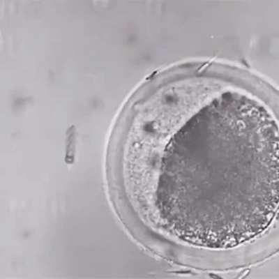 A nanobot helping a sperm with motility issues along towards an egg. These metal helixes are so small they can completely wrap around the tail of a single sperm and assist it along its journey