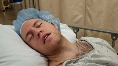 This dude singing "Cielito Lindo" while under anesthesia