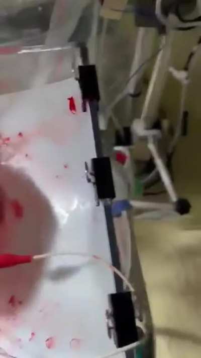 A heart that will be transplanted.