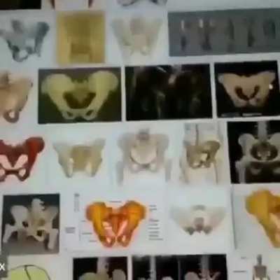 Bone(r)?