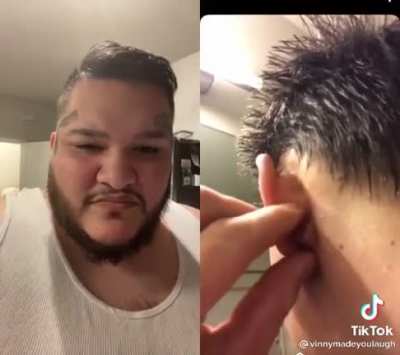 I still don’t understand why people like pimple popping videos