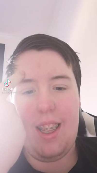 omg guys hes so edgy and cool