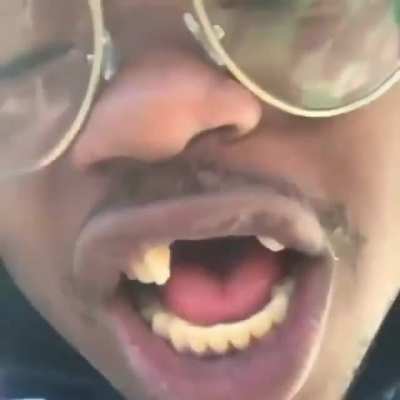 ?——————?