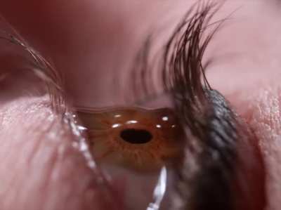 ?Close-up of eye drops in slow motion?