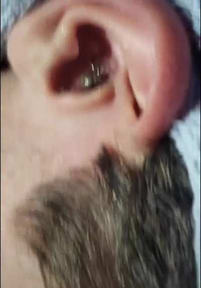 Wcgw having ears