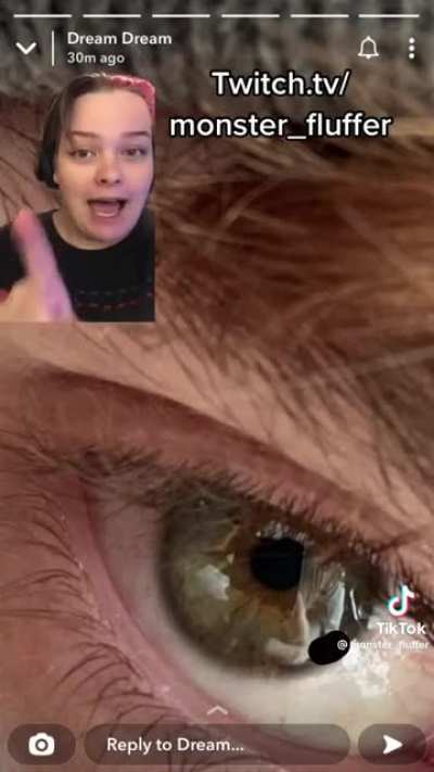 its literally just an eye...