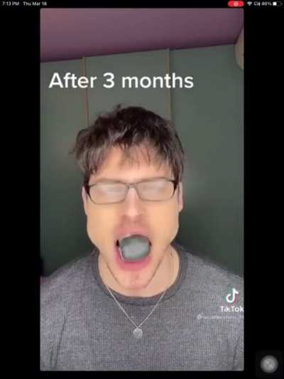 My man’s chin looking like a dorito