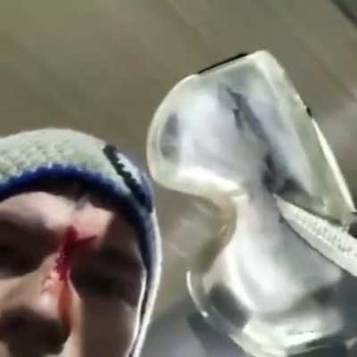 Imagine the damage without the safety glasses