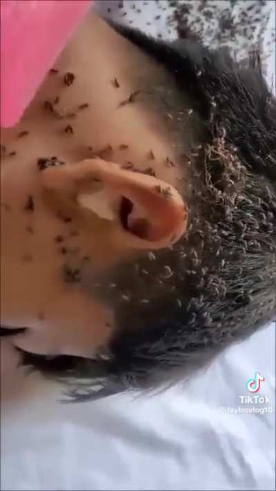 Viral bug fakeouts??