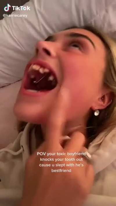 So-called "toxic" boyfriend breaks cheating girlfriend's tooth.