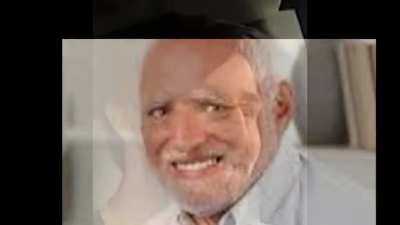 Oh no his face, I’m so sorry dude ;(
