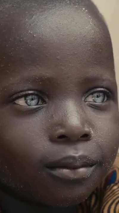Beautiful Blue Eyes Are Amazing ?