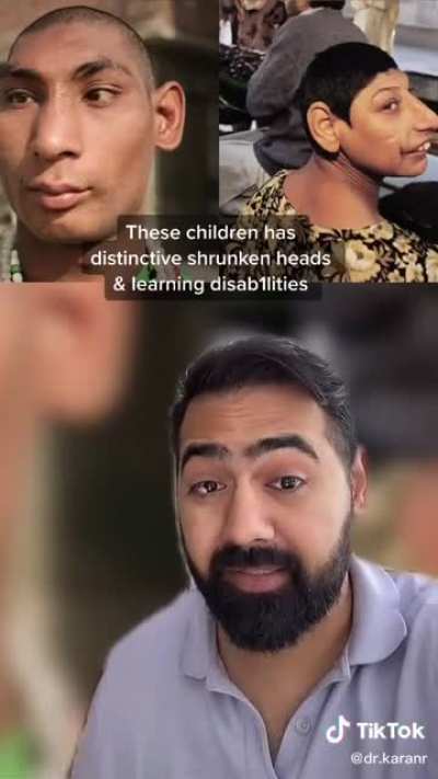 Rat Children of Pakistan