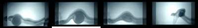 ? Dasypeltis inornata snake eating an egg, X-Ray view