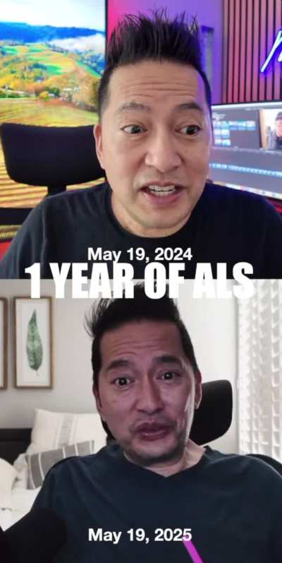 1 year of ALS