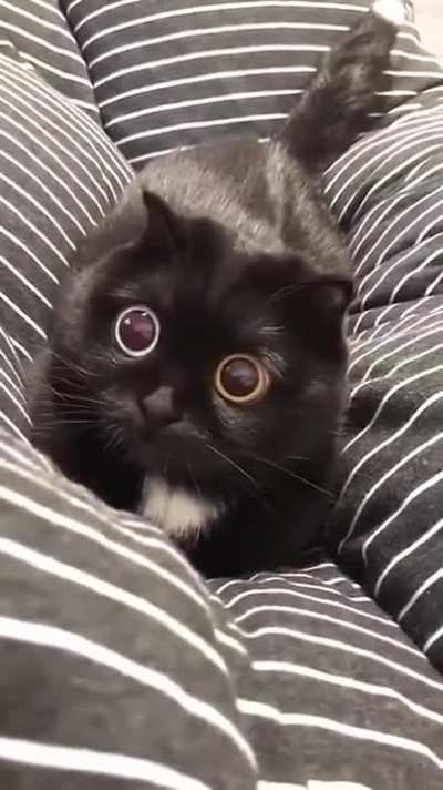 Heterochromia