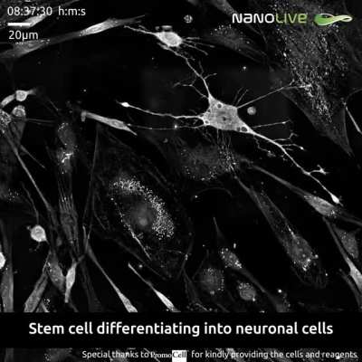"birth" of a Neuron