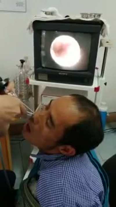 Got a bit of an itch up my nose.