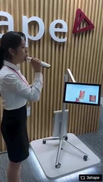 This tooth scanning technology