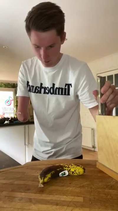 Arm gone