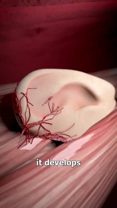 Ear reconstruction surgery from ribcage