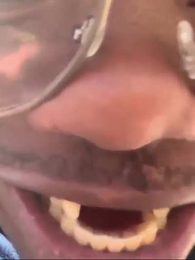 $75 uber drive from his left to right tooth