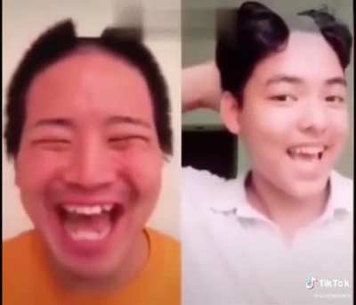 I’ll shave my hair too!