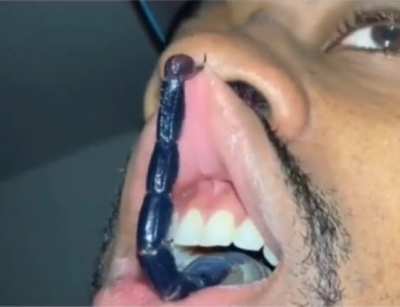 Lip filling.