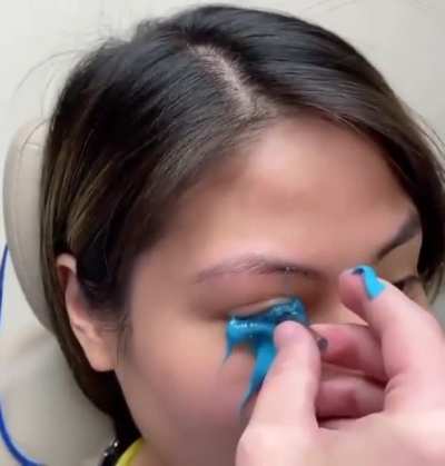 Taking an impression of the ocular surface for produce of scleral lens! ?