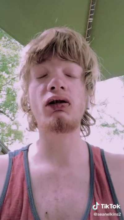 Someone send him the gold teeth please.