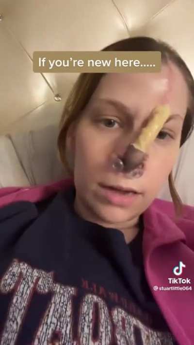 What snorting up to an ounce of cocaine a day can do…