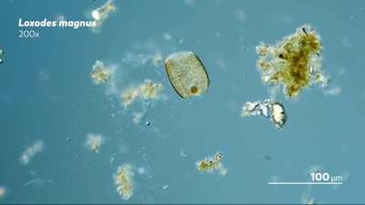 Last moments of a ciliate
