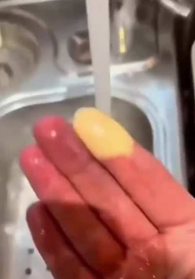 This is how hot water brings blood flow to Raynaud's fingers, a condition where blood vessels narrow due to cold or stress.