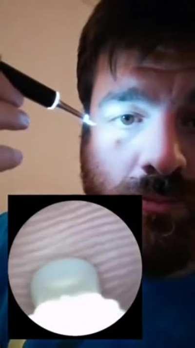 Ear cleaner