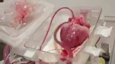 This is what a beating heart ready to be transplanted looks like .