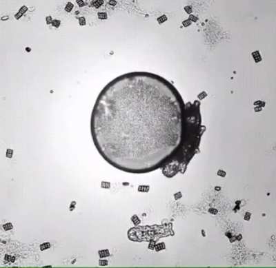 ? A microscopic water bear scratching it's back.