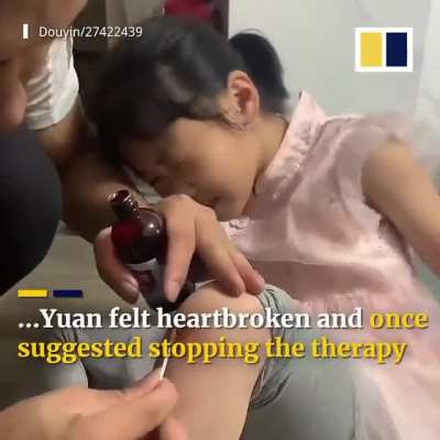 Paralyzed from the waist down from spinal cord injury, 8-year-old daughter can run after 2 years of grueling rehabilitation with help of her unrelenting family